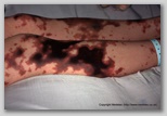 wound image