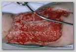 wound image