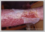 wound image