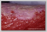 wound image
