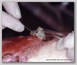 wound image