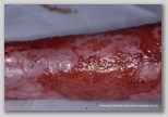 wound image